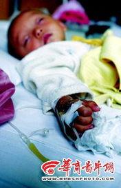 成人铅中毒怎么补救视频,视频解析