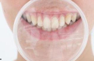 成人换牙的视频在线观看,在线观看换牙视频，了解牙齿健康新视角